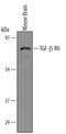 Transforming Growth Factor Beta Receptor 2 antibody, PA5-47719, Invitrogen Antibodies, Western Blot image 