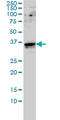 General Transcription Factor IIE Subunit 2 antibody, LS-C197378, Lifespan Biosciences, Western Blot image 