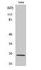 Adenylate Kinase 5 antibody, GTX34359, GeneTex, Western Blot image 