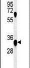 Potassium Channel Tetramerization Domain Containing 1 antibody, PA5-24877, Invitrogen Antibodies, Western Blot image 