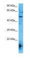Cholinergic Receptor Nicotinic Alpha 6 Subunit antibody, orb327233, Biorbyt, Western Blot image 