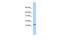 G Protein Subunit Gamma Transducin 2 antibody, GTX45286, GeneTex, Western Blot image 