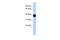 Tyrosylprotein Sulfotransferase 2 antibody, PA5-42595, Invitrogen Antibodies, Western Blot image 