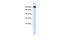 Remodeling And Spacing Factor 1 antibody, 26-348, ProSci, Western Blot image 