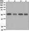 Activin A Receptor Type 1B antibody, ab133478, Abcam, Western Blot image 