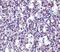 TBC1 Domain Family Member 10C antibody, PA5-20395, Invitrogen Antibodies, Immunohistochemistry paraffin image 