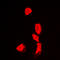 Histone Deacetylase 6 antibody, LS-B16890, Lifespan Biosciences, Immunofluorescence image 