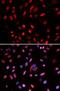 DNA Polymerase Delta 1, Catalytic Subunit antibody, FNab06606, FineTest, Immunofluorescence image 