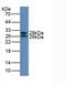 Insulin Like Growth Factor Binding Protein 7 antibody, LS-C295812, Lifespan Biosciences, Western Blot image 