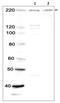 SWI/SNF Related, Matrix Associated, Actin Dependent Regulator Of Chromatin, Subfamily A, Member 4 antibody, GTX00727, GeneTex, Western Blot image 