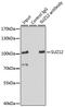 SUZ12 Polycomb Repressive Complex 2 Subunit antibody, GTX64485, GeneTex, Immunoprecipitation image 