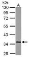 Fructosamine 3 Kinase Related Protein antibody, GTX116830, GeneTex, Western Blot image 