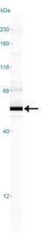 SMAD Family Member 6 antibody, GTX13727, GeneTex, Western Blot image 