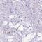 DCC Netrin 1 Receptor antibody, NBP2-49606, Novus Biologicals, Immunohistochemistry frozen image 