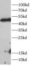 Histone Deacetylase 8 antibody, FNab10275, FineTest, Western Blot image 