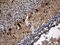 Sortilin Related Receptor 1 antibody, M01887-1, Boster Biological Technology, Immunohistochemistry paraffin image 