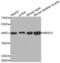 SET And MYND Domain Containing 2 antibody, abx001889, Abbexa, Western Blot image 