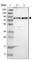 TRNA-YW Synthesizing Protein 1 Homolog antibody, HPA013568, Atlas Antibodies, Western Blot image 