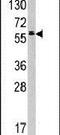 Testis Associated Actin Remodelling Kinase 2 antibody, PA5-14958, Invitrogen Antibodies, Western Blot image 