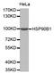 Heat Shock Protein 90 Beta Family Member 1 antibody, STJ24089, St John
