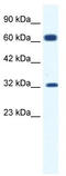 Small conductance calcium-activated potassium channel protein 1 antibody, TA338527, Origene, Western Blot image 