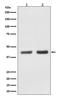 BMI1 Proto-Oncogene, Polycomb Ring Finger antibody, M00313, Boster Biological Technology, Western Blot image 