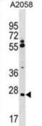 Canopy FGF Signaling Regulator 3 antibody, abx030445, Abbexa, Western Blot image 