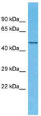 Nuclear Envelope Integral Membrane Protein 1 antibody, TA330788, Origene, Western Blot image 