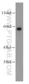Eukaryotic Translation Initiation Factor 2A antibody, 11233-1-AP, Proteintech Group, Western Blot image 