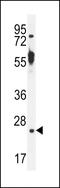 Tetratricopeptide Repeat Domain 9B antibody, 55-933, ProSci, Western Blot image 