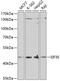 Eukaryotic Translation Initiation Factor 3 Subunit E antibody, 19-668, ProSci, Western Blot image 