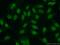 Nibrin antibody, 55025-1-AP, Proteintech Group, Immunofluorescence image 
