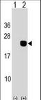 DCMP Deaminase antibody, LS-C167304, Lifespan Biosciences, Western Blot image 