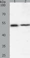 SRY-Box 1 antibody, TA321737, Origene, Western Blot image 