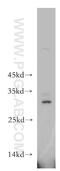 THAP Domain Containing 2 antibody, 20853-1-AP, Proteintech Group, Western Blot image 