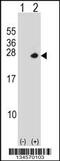 Proteasome 26S Subunit, Non-ATPase 10 antibody, 57-836, ProSci, Western Blot image 