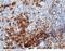 CD38 Molecule antibody, 10818-R228, Sino Biological, Immunohistochemistry frozen image 