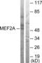 Myocyte Enhancer Factor 2A antibody, LS-B7554, Lifespan Biosciences, Western Blot image 