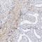 Integrin Subunit Alpha 5 antibody, NBP1-84576, Novus Biologicals, Immunohistochemistry paraffin image 