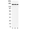 LDL Receptor Related Protein 5 antibody, R31397, NSJ Bioreagents, Western Blot image 