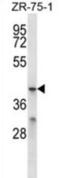 Major Facilitator Superfamily Domain Containing 2B antibody, abx025087, Abbexa, Western Blot image 