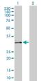 Calponin 2 antibody, H00001265-D01P, Novus Biologicals, Western Blot image 