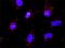 Protein Tyrosine Kinase 2 antibody, H00005747-M01, Novus Biologicals, Proximity Ligation Assay image 