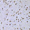 SRY-Box 5 antibody, 22-607, ProSci, Immunohistochemistry paraffin image 