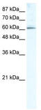 Methyltransferase Like 3 antibody, TA337237, Origene, Western Blot image 