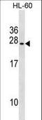 Ubiquitin-conjugating enzyme E2 S antibody, LS-B13775, Lifespan Biosciences, Western Blot image 