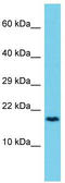 Coiled-Coil Domain Containing 12 antibody, TA331652, Origene, Western Blot image 