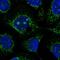 Coiled-Coil Domain Containing 58 antibody, NBP2-55464, Novus Biologicals, Immunofluorescence image 