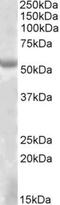 EYA Transcriptional Coactivator And Phosphatase 1 antibody, NBP1-46136, Novus Biologicals, Western Blot image 