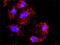 Protein Kinase C Alpha antibody, H00005578-M01, Novus Biologicals, Proximity Ligation Assay image 